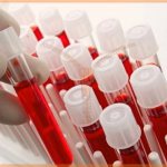 боязнь крови