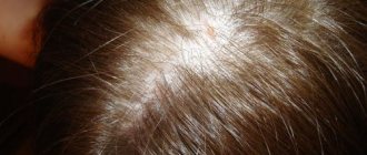Как долго восстанавливаются волосы после выпадения при стрессе