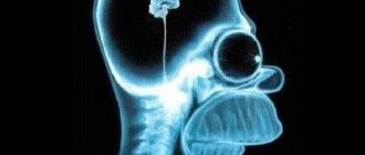 What level of IQ is considered normal?