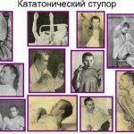 Catatonic stupor. What is it, what is it characterized by, treatment, causes 
