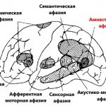 Classification of aphasias according to Luria