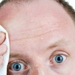 Потливость при стрессе