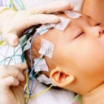 Противосудорожные препараты при эпилепсии без рецептов