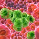 Раковая клетка.