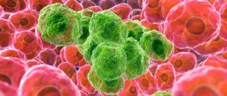 Раковая клетка.