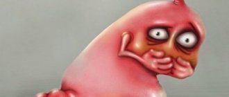 Stomach upset