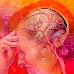 Соматоформная дисфункция ВСД