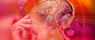 Somatoform dysfunction of VSD