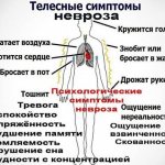 Thermoneurosis. What is it, symptoms, causes and treatment in adults, children 