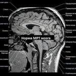 Head tremor with excitement. Reasons, how to get rid of it, treatment 