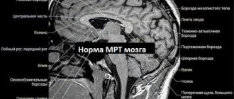 Head tremor with excitement. Reasons, how to get rid of it, treatment